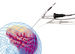 Neurochirurgia
