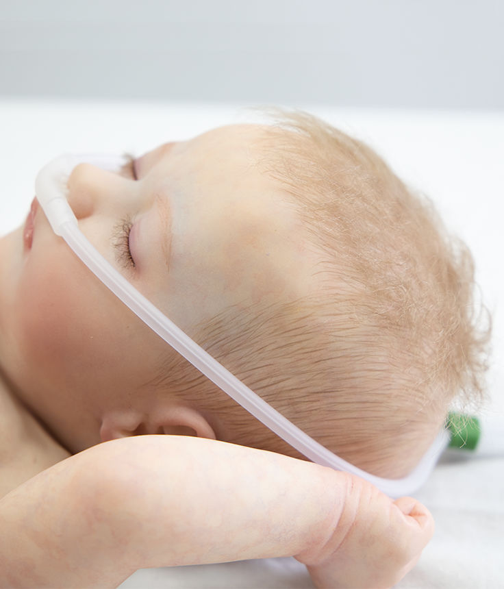 Cannula Nasale A Ossigeno Nioflo MEKICS Pediatrica Neonatale