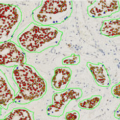 modulo software di oncologia / di visualizzazione / diagnostico / per immunoistochimica