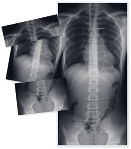 software di fusione / per radiografia / per dipartimento di radiologia / per ambulatorio