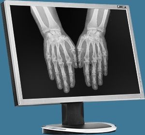 software di visualizzazione DICOM / di interoperabilità / per diagnostica per immagini / per dipartimento di radiologia