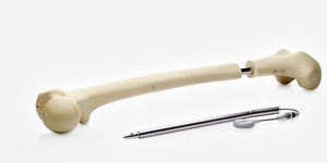 chiodo intramidollare femore / tibia / prossimale / distale