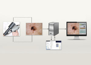 software di diagnosi cutanea / dermatologia / per dipartimento di dermatologia