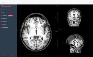software diagnostico / per reportistica / di visualizzazione 3D / di pianificazione