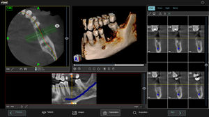 software di gestione dei referti dei pazienti / per reportistica / di visualizzazione 3D / di simulazione