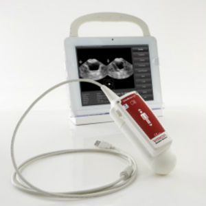 scanner vescicale ad ultrasuoni portatile