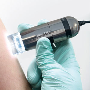 dermatoscopio video / a LED / da tasca / USB