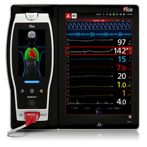 monitor multiparametrico ECG / TEMP / PNI / SpO2