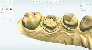 software di progettazione / odontoiatrico