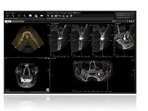 software di analisi / diagnostico / per tomografia computerizzata / odontoiatrico
