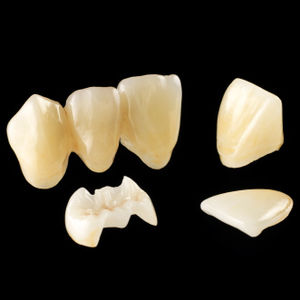 materiale odontoiatrico in ceramica di vetro / in disilicato di litio / per restauro dentale / CAD CAM