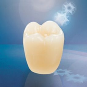 protesi dentale in composito / per denti posteriori