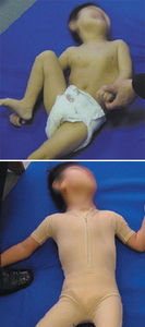 tuta ortopedica di correzione posturale / pediatrica