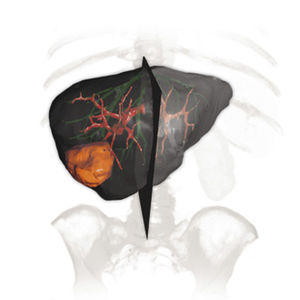 modulo software di simulazione 3D / di analisi / per radiografia / per chirurgia