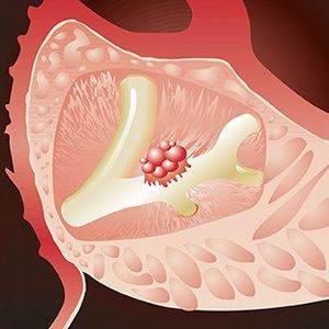 anticorpi monoclonali / oncologici / di CA 19-9