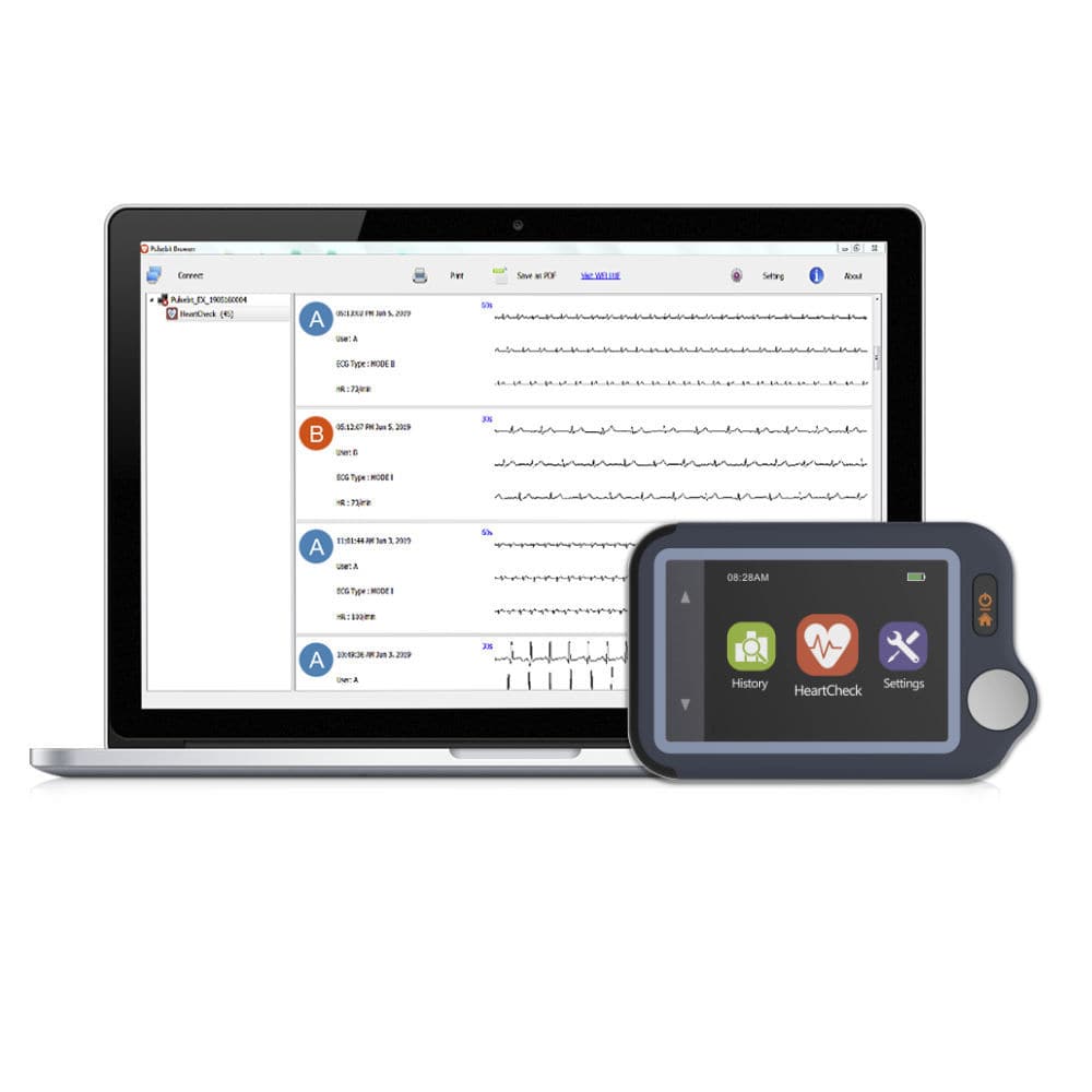 Holter ECG 1 Canale - Pulsebit EX - Viatom By Lepu