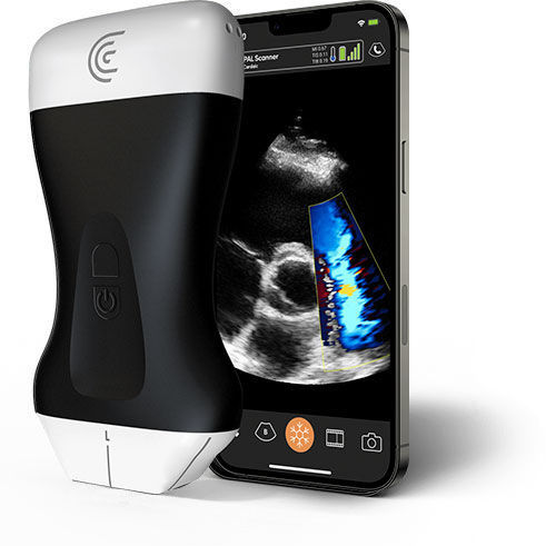 Ecografo palmare - PAL - Clarius Mobile Health - per ecografia ...