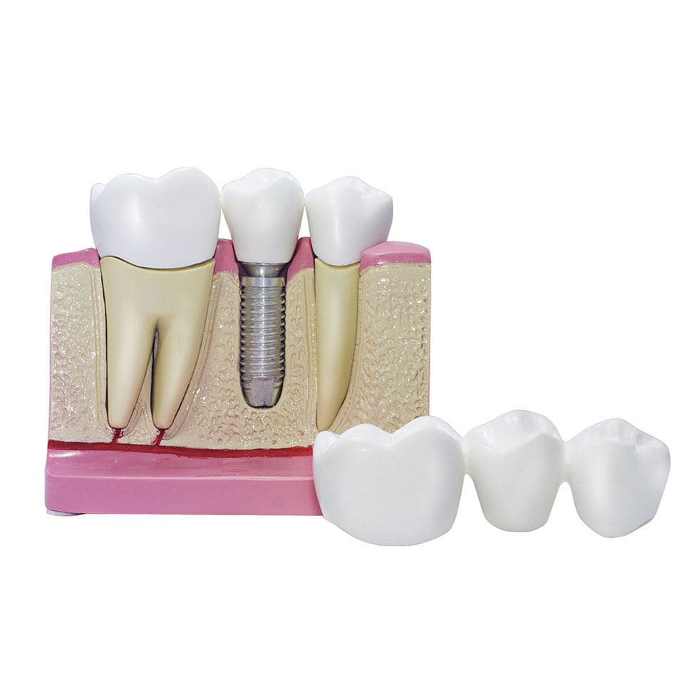 1 Pz Studio Odontoiatrico Modello Colgate 2 Volte Grande Con - Foto 8