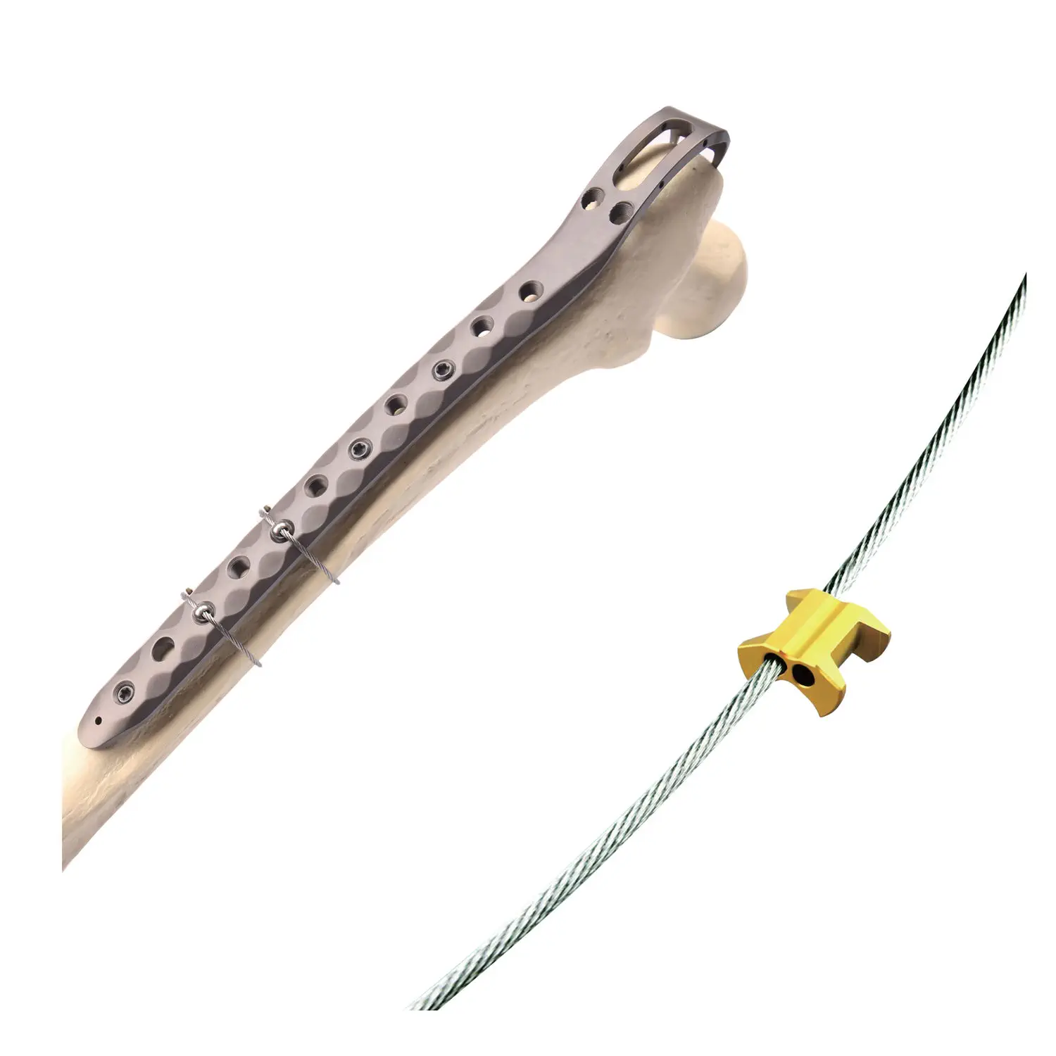 Mini Guardia Per Allenamento Baseball FUJIEYU - In Acciaio Inox, Con Gancio E Cintura, Per Protezione Fitness - Foto 2