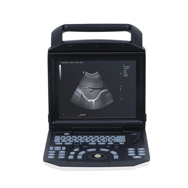 Ecografo portatile - YSB-M5 - YSENMED - per ecografia multidisciplinare ...