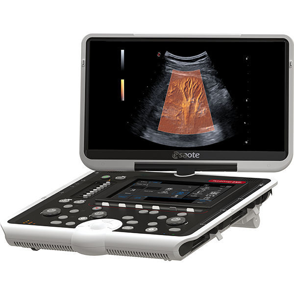 Ecografo portatile - MyLab™Omega eXP - Esaote - per ecografia ...