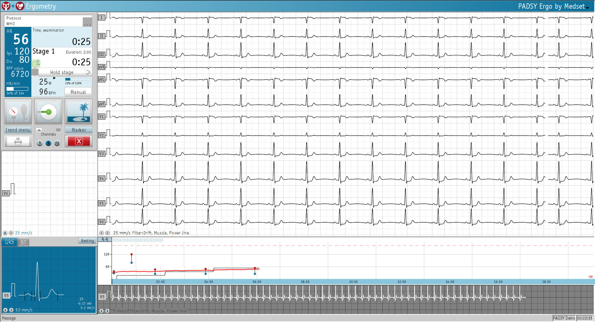 Software per postazione di prova da sforzo cardiorespiratorio PADSY Ergo Medset