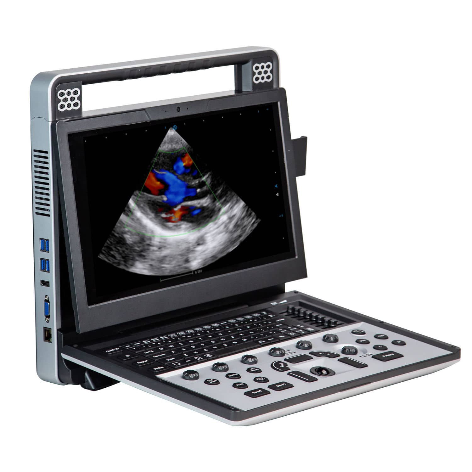 Ecografo portatile - Apogee C5 - SIUI - per ecografia multidisciplinare ...