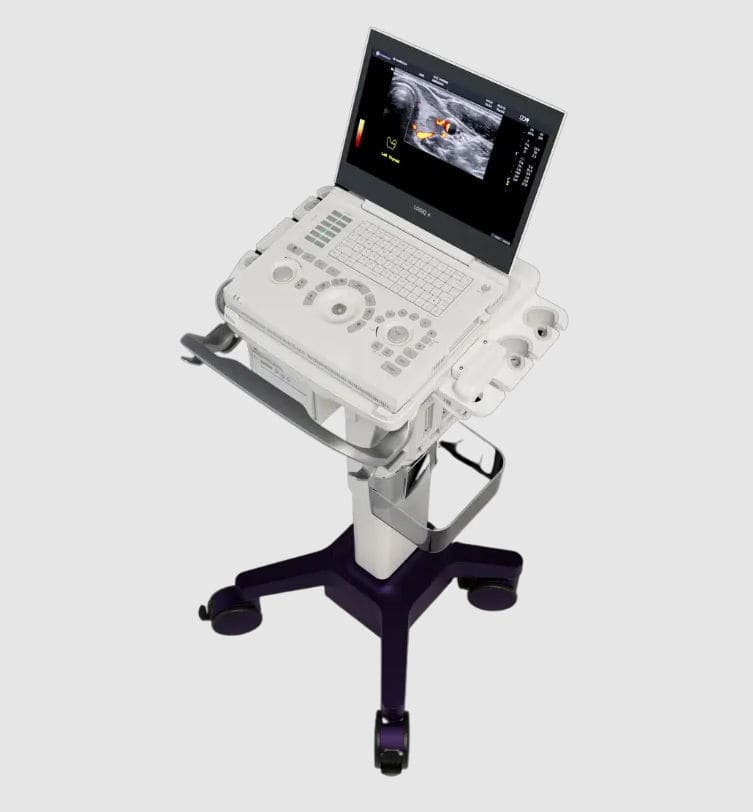 Ecografo portatile con carrello - LOGIQ™ e - GE Healthcare - per ...
