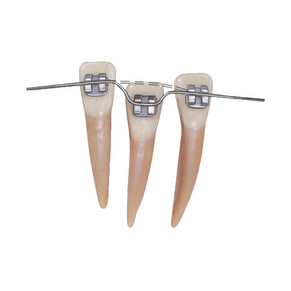 10 Fili Per Arco Dentale Super Elastici NITI/Acciaio Inox - Confezione