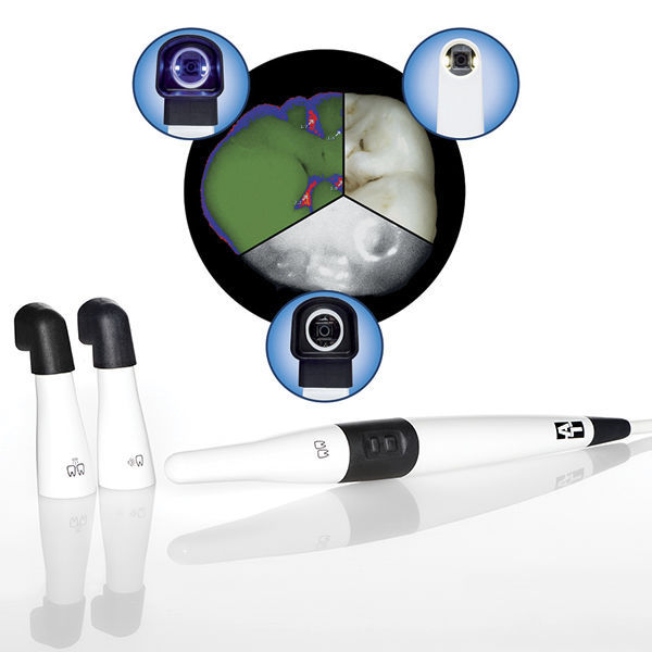 Fotocamera Intraorale DARYOU DY-50 - Compatibile Con Software Dentali, Pulsante Integrato, Messa A Fuoco Automatica - Foto 2