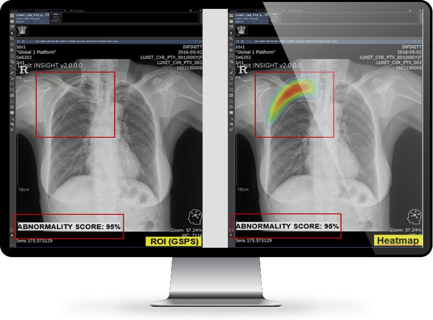 Software Medico Infinitt North America Per Radiologia Di Analisi