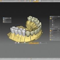 Software per laboratorio dentale / per implantologia...