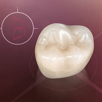 Protesi dentale in composito / per denti...