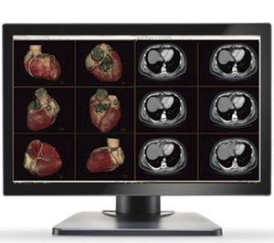 monitor medico 1