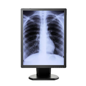 monitor medico 1