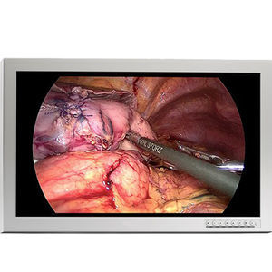 monitor chirurgico 1