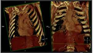 monitor medico 1