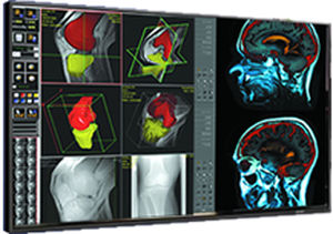 monitor medico 1