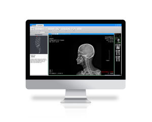 PACS per diagnostica per immagini