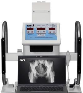 unità mobile di radiografia DR