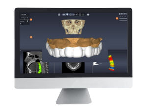 software di progettazione 1