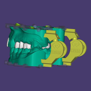 modulo software per implantologia dentale