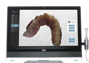 scanner 3D per clinica odontoiatrica / intraorale