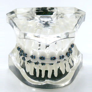 modello anatomico di dentatura