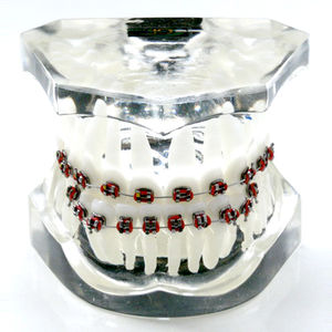 modello anatomico di dentatura 1