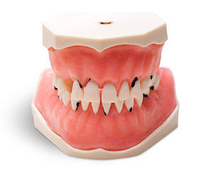 modello anatomico di denti 1