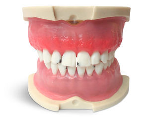 modello anatomico di denti 1