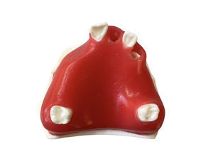modello anatomico gengivale 1