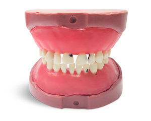 modello anatomico di denti 1