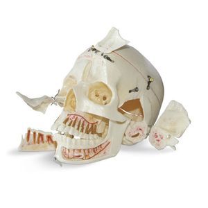 modello anatomico di cranio